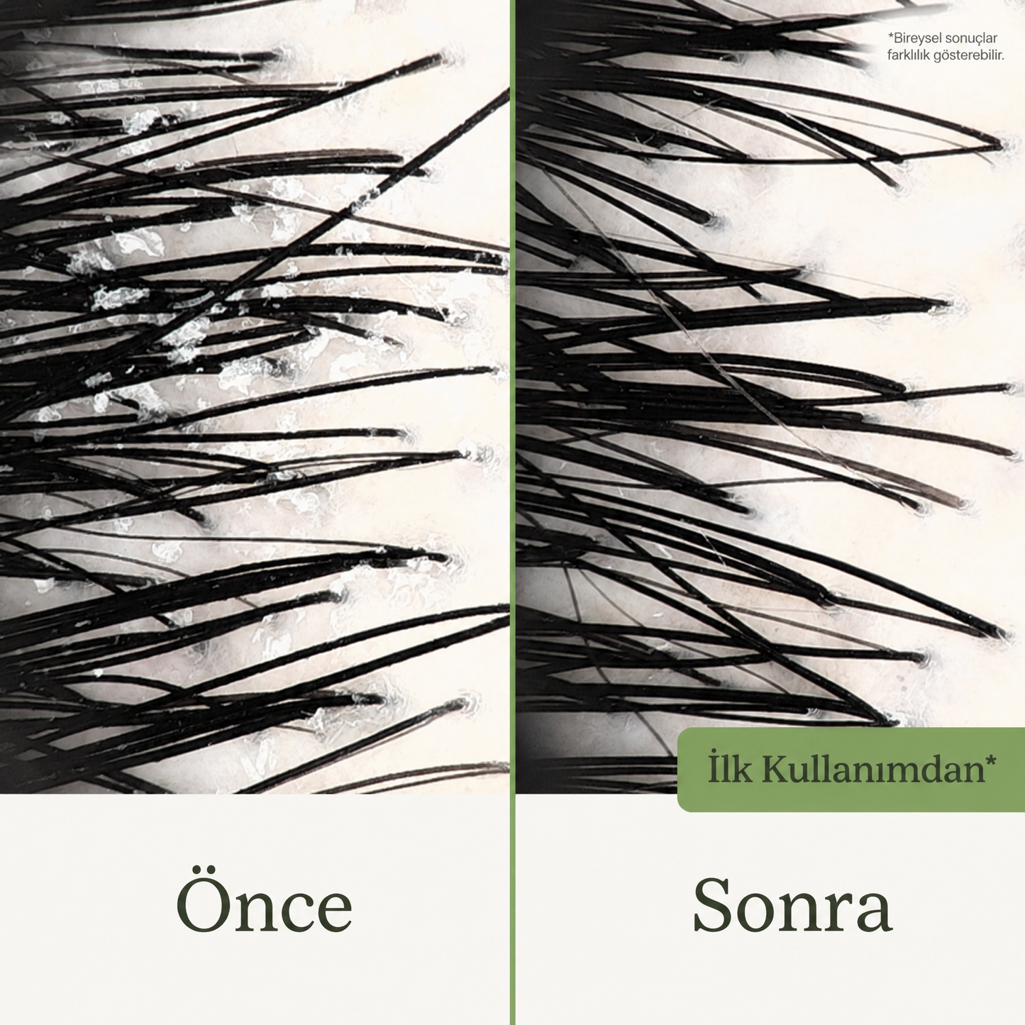 KÖKE Güçlendirici Şampuan