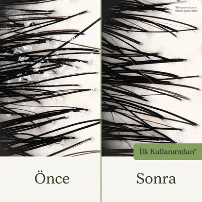 KÖKE Güçlendirici Şampuan
